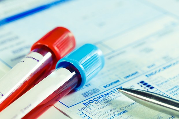 NHS set to roll out Blood test to detect 50 types of cancer