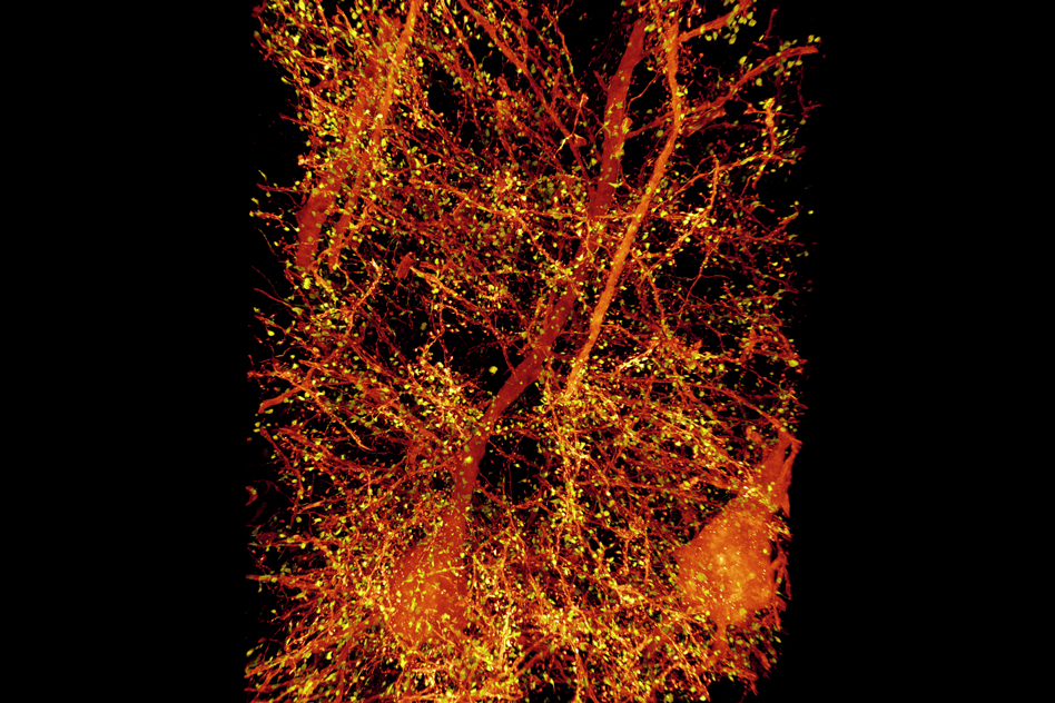 New 3-D imaging technique reveals stunning images of the brain at work 5 New 3-D imaging technique reveals stunning images of the brain at work Manufacturing