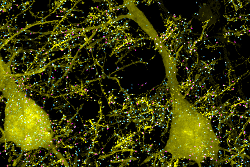 New 3-D imaging technique reveals stunning images of the brain at work 3 New 3-D imaging technique reveals stunning images of the brain at work Manufacturing
