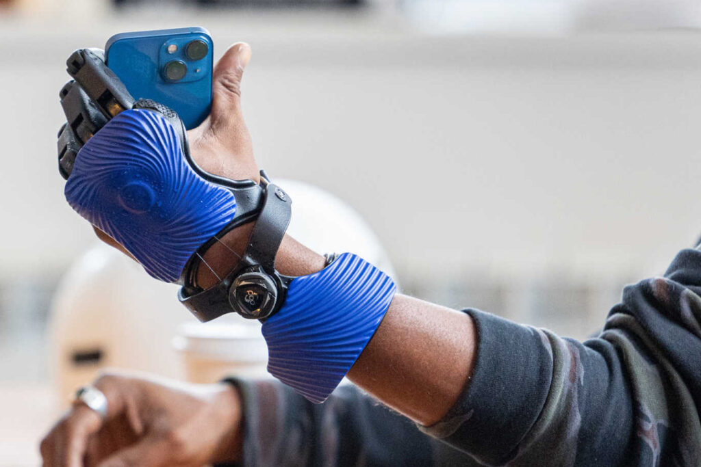 Open Bionics Pioneers 3D Printed “Hero Gauntlet” for Partial Hand Amputees