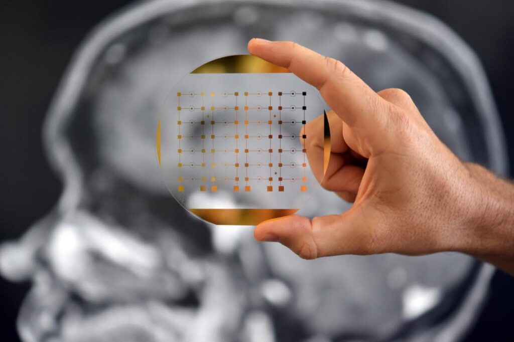 Nanotech Chip Opens New Window into Brain Cancer Monitoring