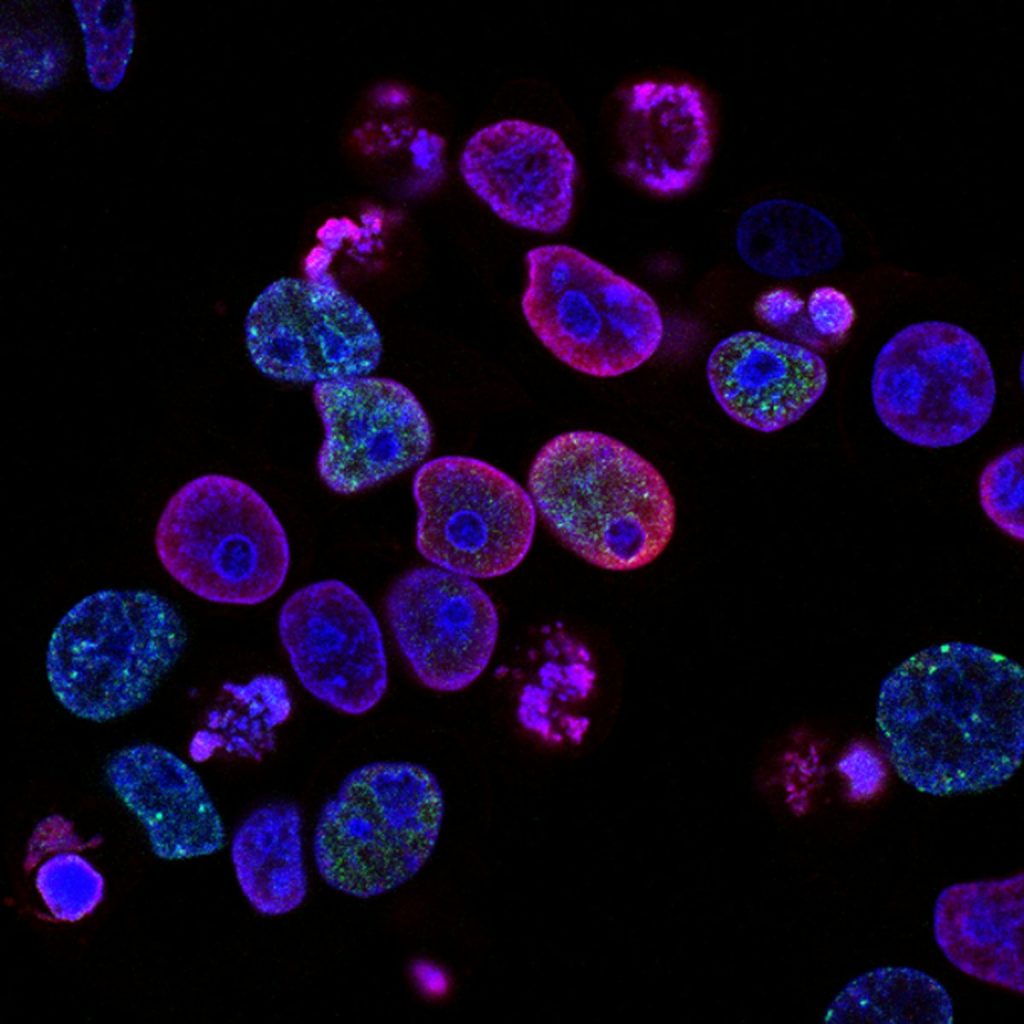 Magnetobot Cancer Treatment: Aston Engineers Living Magnetic Bacteria