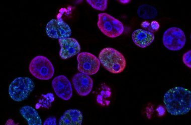 engineering careers Magnetobot Cancer Treatment: Aston Engineers Living Magnetic Bacteria